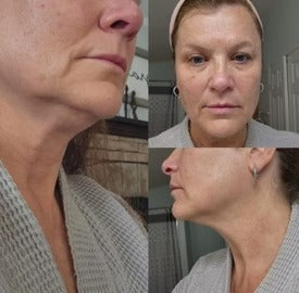 Lumeya Lenf Işıltı Fırçası®